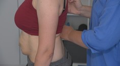 Diastáza trápi najmä tehotné ženy a ženy po pôrode. Netreba ju podceniť, pomôcť môže vhodné cvičenie