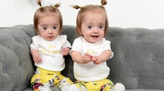 Týchto rozkošných dvojičiek sa rodičia boja čo i len dotknúť