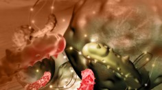 Rakovina krčka maternice môže byť prvá, ktorá bude na Slovensku takpovediac vyhubená