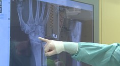 Inovácie v operácii zápästia. Namiesto jeho znehybnenia lekári dokážu kĺb vymeniť