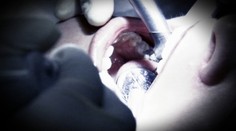 Panika medzi pacientmi : Zubár mohol nakaziť tisíce ľudí