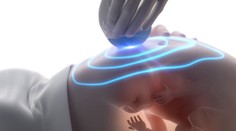 Aliancia za rodinu žiada odvolať pôrodníka Záhumenského. Ten kritizoval návrh SNS sprísniť interrupcie