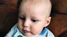 Chlapec so zvláštnym znamienkom. Aké číslo vidíte na jeho čele?