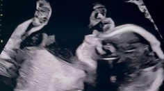 Prešli si niekoľkými potratmi a teraz? Dieťa číslo tri je na ceste