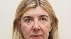 Čo dokáže plastika! Tejto žene ubrala 20 rokov a vyzerá úžasne