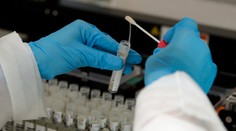 Prečo stále masívnejšie netestujeme ľudí na koronavírus? Takto to vysvetlil Matovič