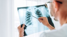 Šíri sa syndróm bielych pľúc. Antibiotika nepomáhajú, jedna skupina je ohrozená viac