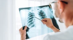 Šíri sa syndróm bielych pľúc. Antibiotika nepomáhajú, jedna skupina je ohrozená viac