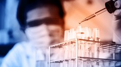 Svetu sa podarilo zvrátiť šírenie AIDS