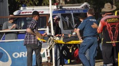 Austráliu šokoval desivý incident: Žena prišla o ruku pri útoku vlastného psa, na mieste ho utratili