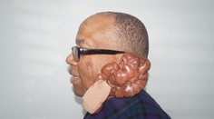 Bola to bežná návšteva u holiča, dve ranky od žiletky mu zničili život