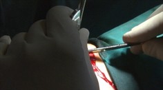 Kastrácia sexuálnych deviantov: Trest či úľava?