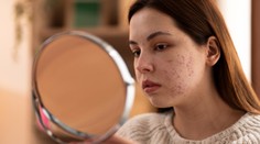 Bežné príznaky na tvári signalizujú vážny problém s hladinou cukru. Lekár vymenoval, čo si musíte všímať