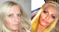 Preplastikovaná Francúzka! Chce vyzerať ako nafukovacia panna