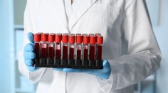 Príčina smrti rodiny, ktorá zomrela počas dovolenky, bola dlho záhadou. Desivú pravdu odhalili laboratórne testy