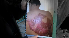 Bojujme za svoje práva. Muž dokázal, že lekári pochybili