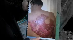 Bojujme za svoje práva. Muž dokázal, že lekári pochybili