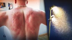 „Nedá sa im ubrániť, sú ako zmutované!“ Ivana z Chorvátska takto doriadili stovky komárov