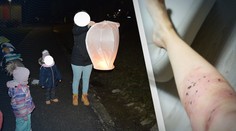 Obetavá mamička chránila deti pred ohňostrojom na sídlisku vlastným telom