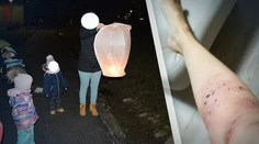 Obetavá mamička chránila deti pred ohňostrojom na sídlisku vlastným telom