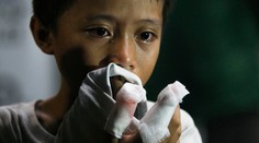 Takto poskytnete prvú pomoc pri zranení pyrotechnikou