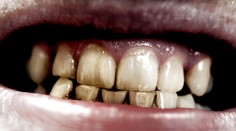 Pozor na týchto deväť mýtov. Môžu vás pripraviť nielen o krásny úsmev