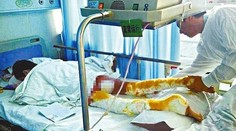 Dievča (13) sa polialo vriacou vodou. Otec jej začal hojiť rany naftou