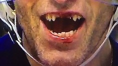 Jágr prišiel o štyri zuby, ale berie to s humorom