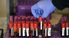 Experiment odhalil, prečo sa niektorí ľudia infikujú koronavírusom a iní nie