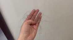 Vlasy sú odrazom zdravia: Po zime vypadávajú, kedy však treba spozornieť?