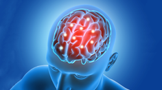 Obrovská štúdia odhaľuje znepokojivú možnú príčinu jednej z najnebezpečnejších chorôb