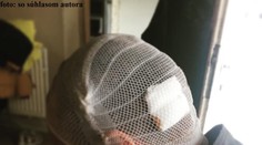 Humenčan vyčíňal ako zmyslov zbavený: Povybíjal okná a zbil manželov v ich dome, kde boli aj deti