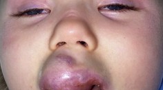 Dievčatku narástol nádor a nemohlo sa smiať. Stal sa vianočný zázrak