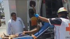 Prežil nemožné. Uvoľnená tyč zo stavby prepichla chlapcovi hlavu
