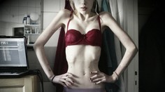 Vážila len 39 kíl! Pozrite si, čo mladučkú anorektičku zachránilo