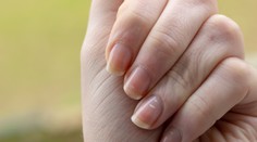Biele škvrny či ryhy na nechtoch. Môžu poukazovať na nedostatok vitamínov, ale aj vážne ochorenia
