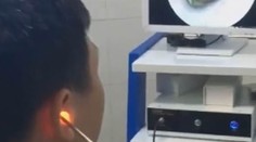 VIDEO: Muža bolelo ucho. Počas návštevy doktora sa jeho prognóza naplnila