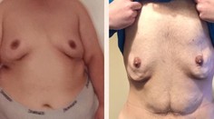 Neuveriteľná premena 200-kilového chlapa. Pozrite, ako vyzerá dnes