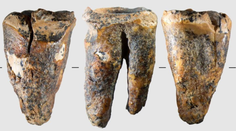 Vedci zostali po objave v šoku. Neandertálec si mal pred 59-tisíc rokmi „vyvŕtať“ pokazený zub
