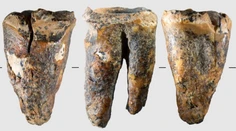 Vedci zostali po objave v šoku. Neandertálec si mal pred 59-tisíc rokmi „vyvŕtať“ pokazený zub