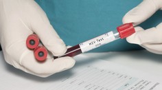 Prípadov HIV na Slovensku pribúda, za posledné tri roky ide o historicky najvyšší výskyt