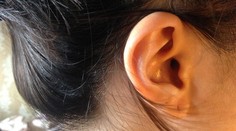 Zapálila sa vám dierka? Pomôže náušnica zo vzácneho kovu