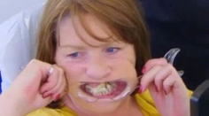 Žena sa bála zubára. Chrup si zalepila sekundovým lepidlom