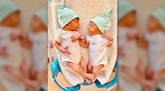 Raritný pôrod pod Tatrami. Bratia dvojičky prišli na svet každý iným spôsobom