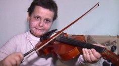 Sedemročný Tomáško trpí vzácnou chorobou. Zabíjajú ho slnečné lúče