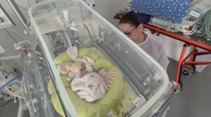 Predčasne narodené deti nevedia samostatne dýchať. V B. Bystrici im k tomu pomáha nová technológia