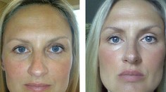 Tvár si zmenila bez akejkoľvek plastiky. Ako to dokázala?