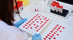 Vedci objavili novú krvnú skupinu. Zatiaľ je jej nositeľkou jediná žena na celom svete