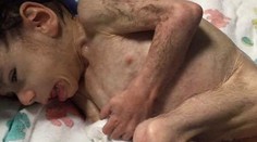 Sedemročný chlapec vážil necelé štyri kilá! Takto vyzerá dnes