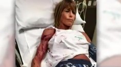 Ženu napadla rozzúrená kengura: Čím viac som kričala, tým viac na mňa útočila